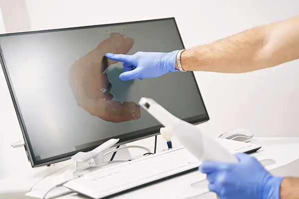  A dentist pointing at a 3D rendering on a computer monitor 